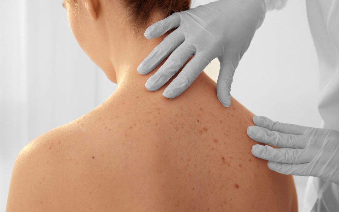 Advanced Treatments for Skin Tightening & Cellulite Control